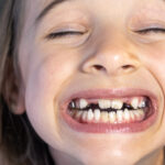 Little happy kid girl at dentist office smiling showing overbite teeth, child during orthodontist visit and oral cavity check-up, children tooth care and hygiene.